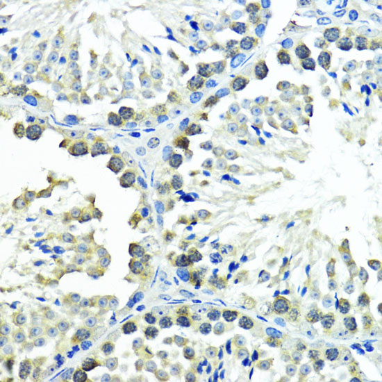 [KO Validated] SUMO1 Rabbit polyclonal antibody