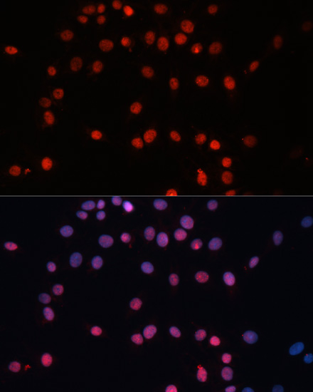 [KO Validated] SUMO1 Rabbit polyclonal antibody