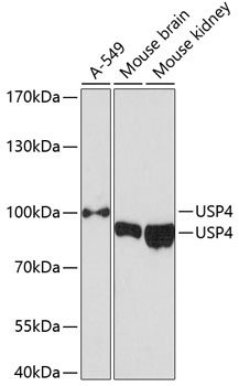USP4 Rabbit polyclonal antibody