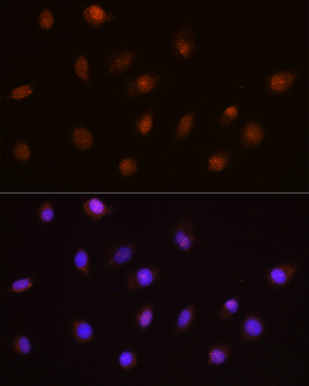 USP4 Rabbit polyclonal antibody