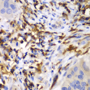 HCLS1 Rabbit polyclonal antibody