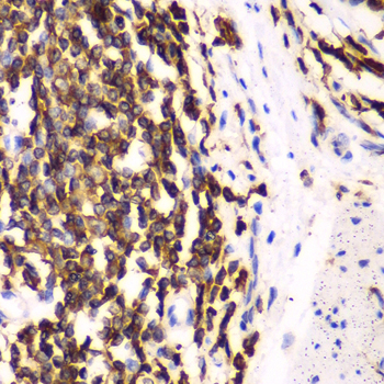 HCLS1 Rabbit polyclonal antibody