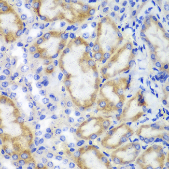 HCLS1 Rabbit polyclonal antibody