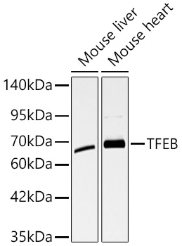 TFEB Rabbit polyclonal antibody