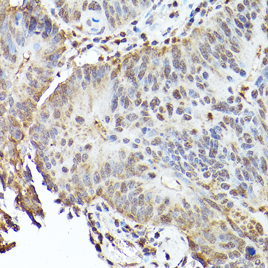 TFEB Rabbit polyclonal antibody