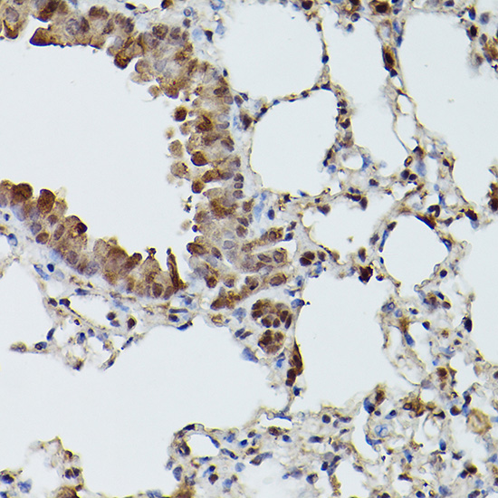 TFEB Rabbit polyclonal antibody