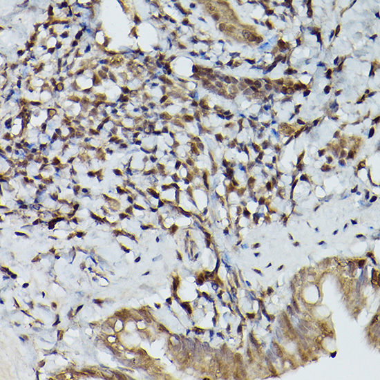 TFEB Rabbit polyclonal antibody