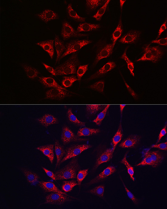 TFEB Rabbit polyclonal antibody