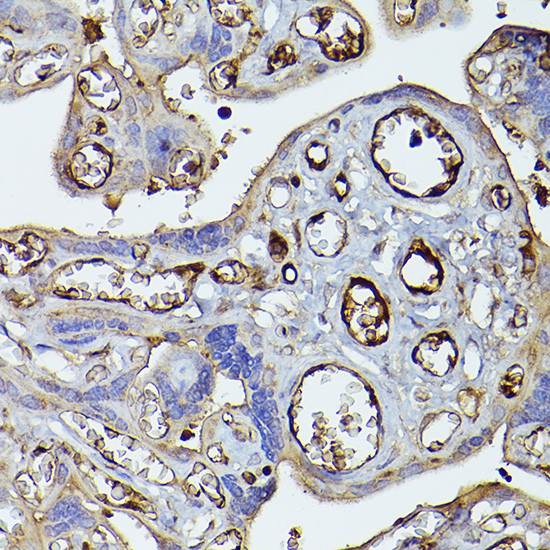 Complement factor H Rabbit polyclonal antibody