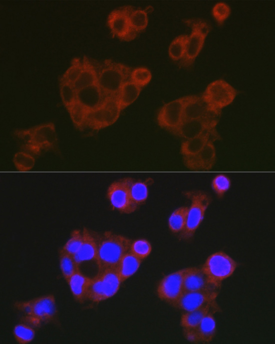 Complement factor H Rabbit polyclonal antibody
