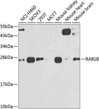 RAB1B Rabbit polyclonal antibody
