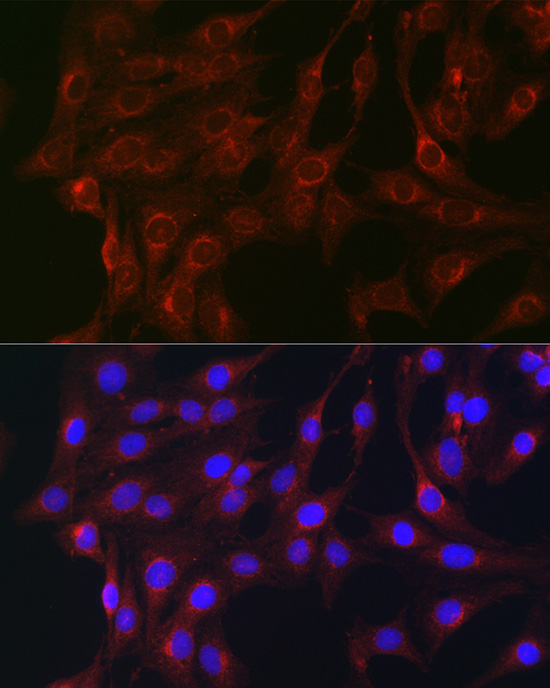 RAB1B Rabbit polyclonal antibody