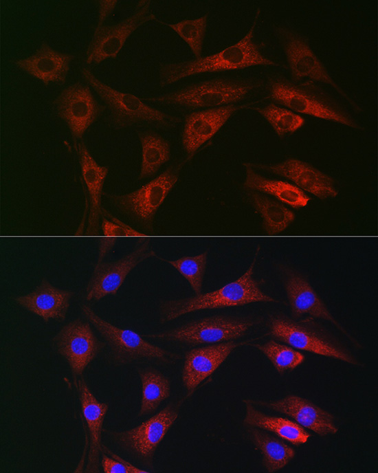 RAB1B Rabbit polyclonal antibody
