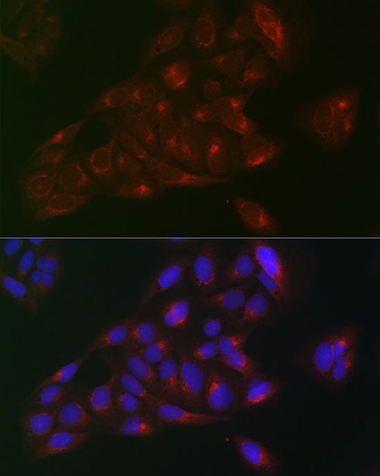 RAB1B Rabbit polyclonal antibody