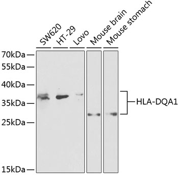 HLA-DQA1 Rabbit polyclonal antibody