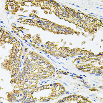 HLA-DQA1 Rabbit polyclonal antibody