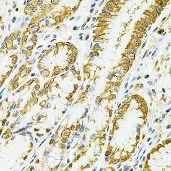 HLA-DQA1 Rabbit polyclonal antibody