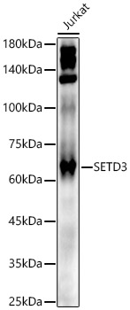 SETD3 Rabbit polyclonal antibody