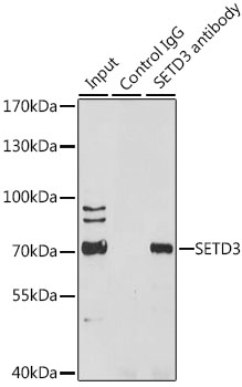 SETD3 Rabbit polyclonal antibody