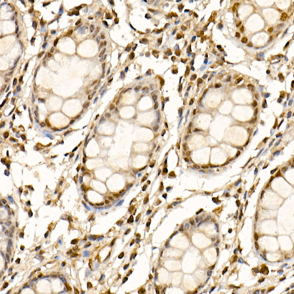 Cullin 1 Rabbit polyclonal antibody