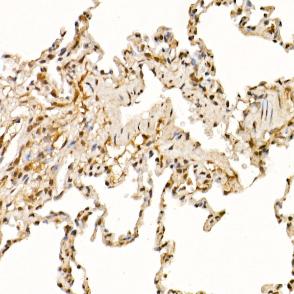 Cullin 1 Rabbit polyclonal antibody