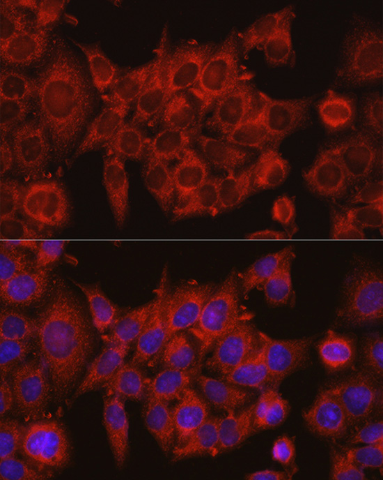 IDH1 Rabbit polyclonal antibody