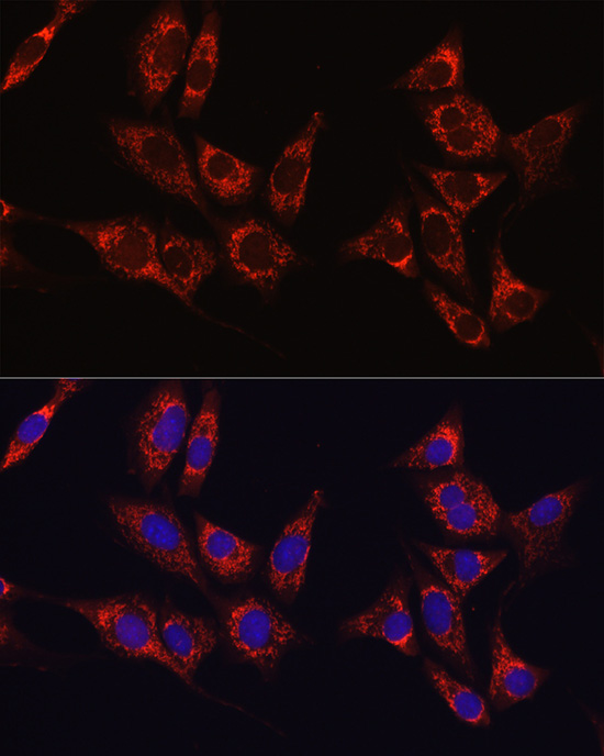 IDH1 Rabbit polyclonal antibody