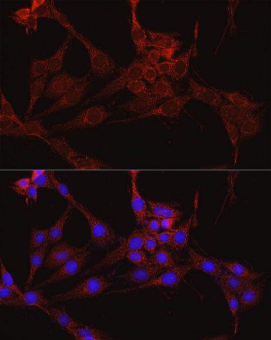 IDH1 Rabbit polyclonal antibody