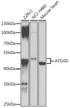 ATG4D Rabbit polyclonal antibody