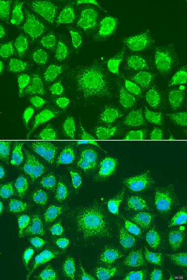 ATG4D Rabbit polyclonal antibody