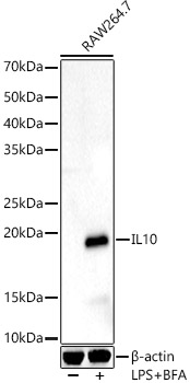 IL10 Rabbit polyclonal antibody