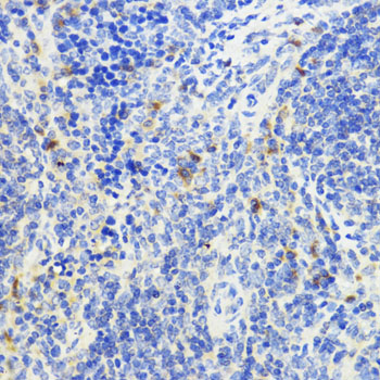 IL10 Rabbit polyclonal antibody