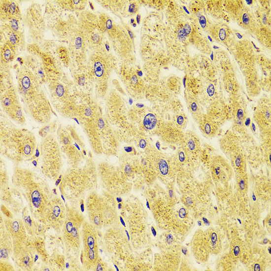 TXNL1 Rabbit polyclonal antibody
