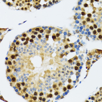 TXNL1 Rabbit polyclonal antibody