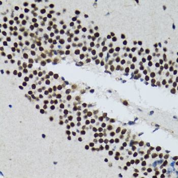 TXNL1 Rabbit polyclonal antibody