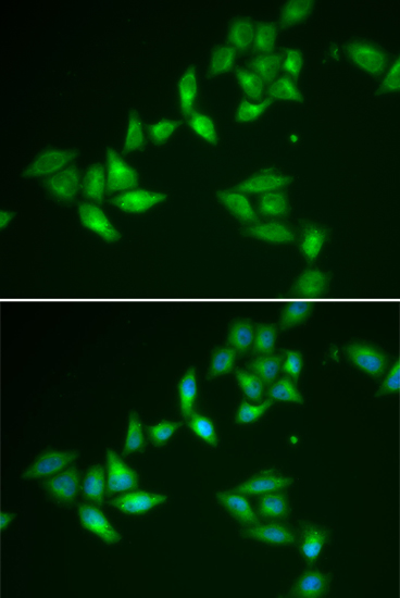 TXNL1 Rabbit polyclonal antibody