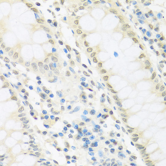 IRF3 Rabbit polyclonal antibody
