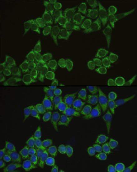 IRF3 Rabbit polyclonal antibody