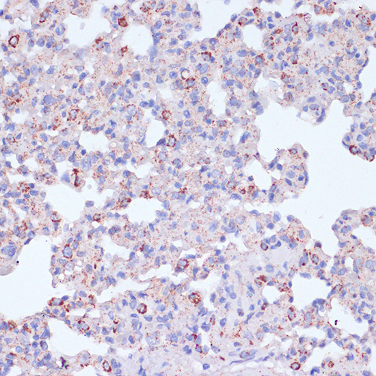 CD18 Rabbit polyclonal antibody