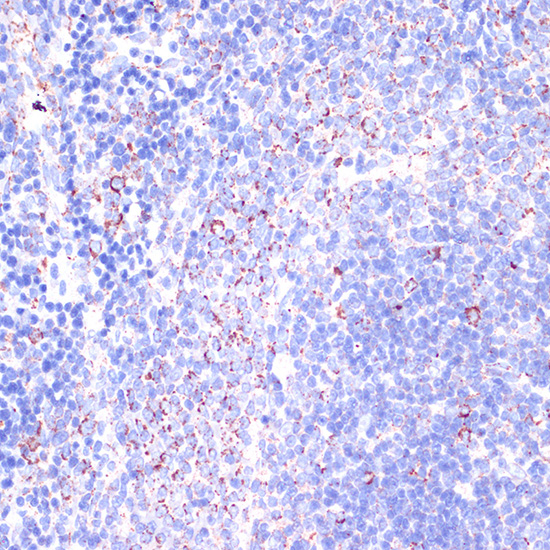 CD18 Rabbit polyclonal antibody