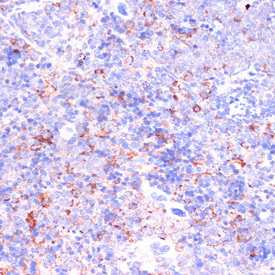 CD18 Rabbit polyclonal antibody