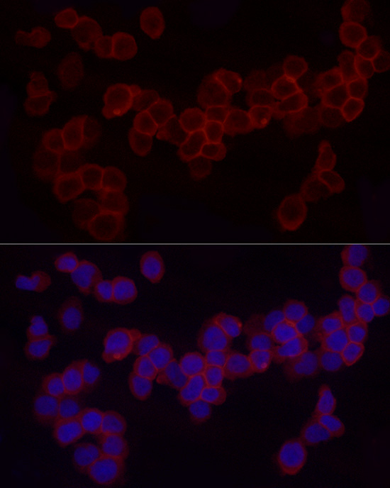 CD18 Rabbit polyclonal antibody