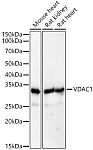 Western blot - [KD Validated] VDAC1 Rabbit pAb (A21730)