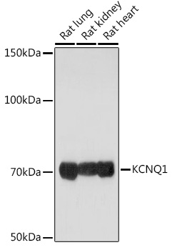 KCNQ1 Rabbit polyclonal antibody