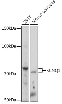 KCNQ1 Rabbit polyclonal antibody