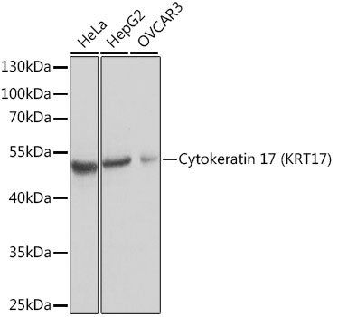 Cytokeratin 17 (KRT17) Rabbit polyclonal antibody
