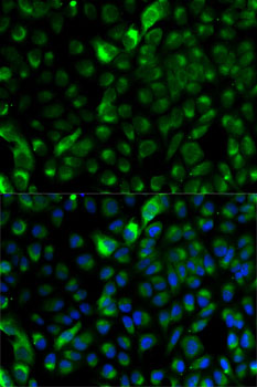 Cytokeratin 17 (KRT17) Rabbit polyclonal antibody