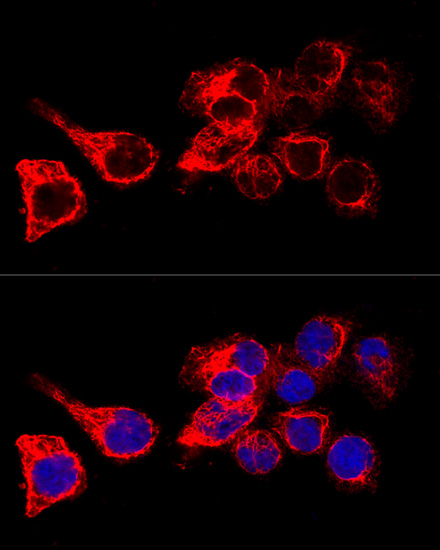 Cytokeratin 17 (KRT17) Rabbit polyclonal antibody