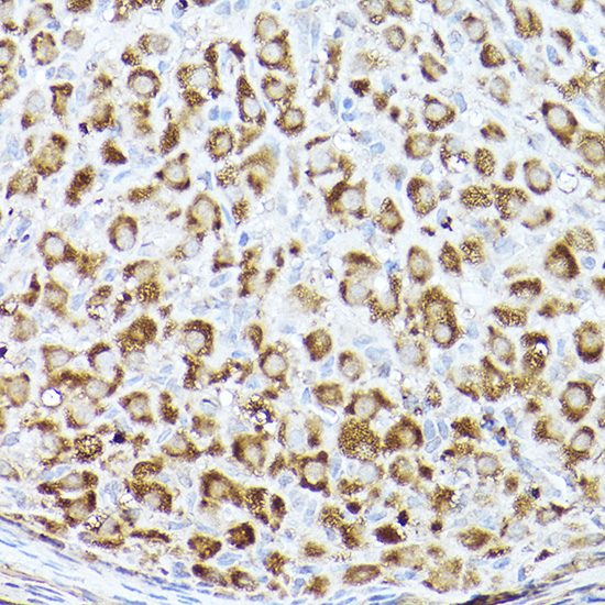 ACC1 Rabbit polyclonal antibody