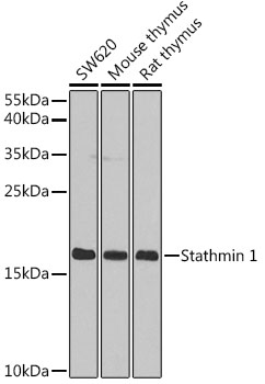 Stathmin 1 Rabbit polyclonal antibody